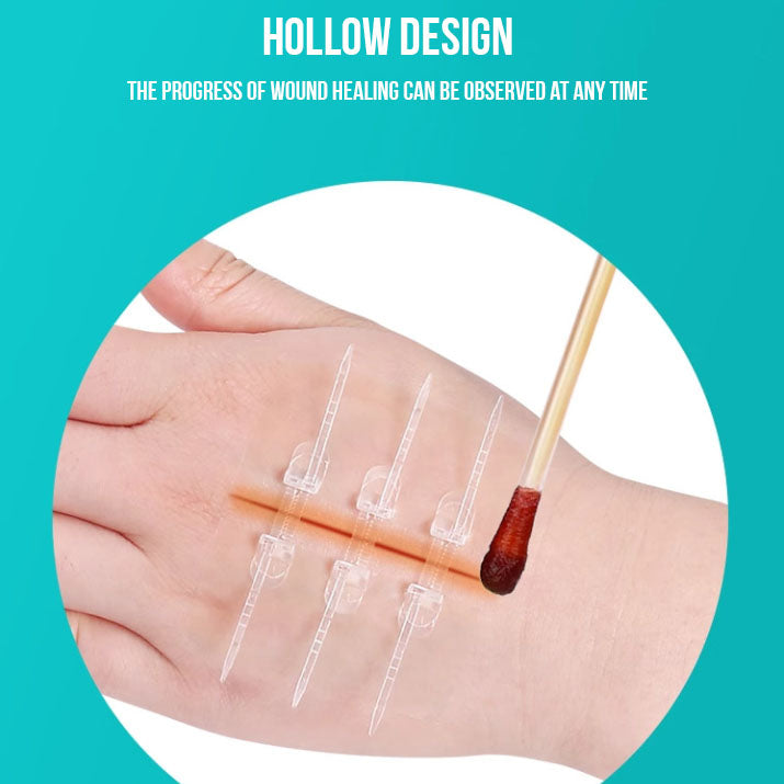 No-Stitch Wound Strips