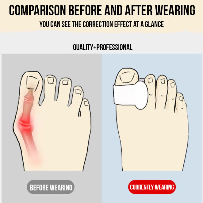 ToeAlign Gels