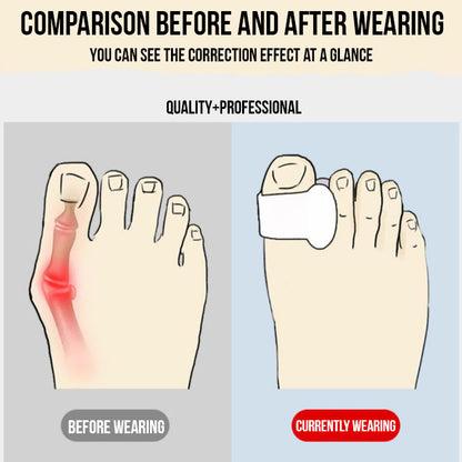 ToeAlign Gels