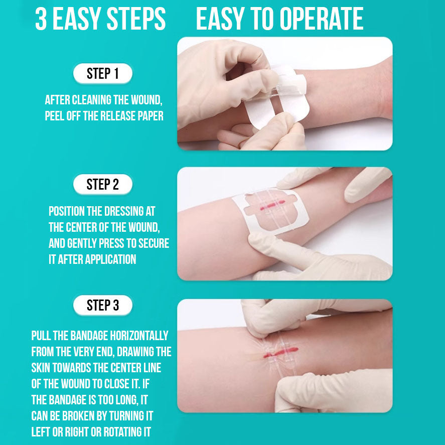 No-Stitch Wound Strips