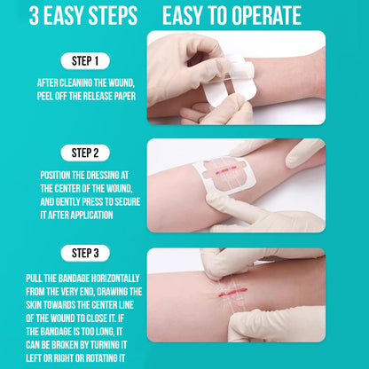 No-Stitch Wound Strips