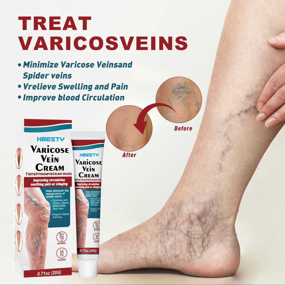 Leg Vein Cream