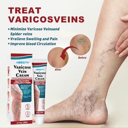 Leg Vein Cream