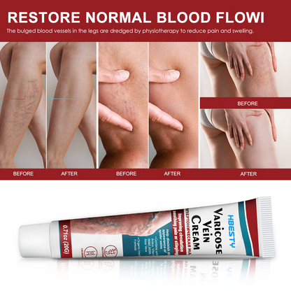 Leg Vein Cream